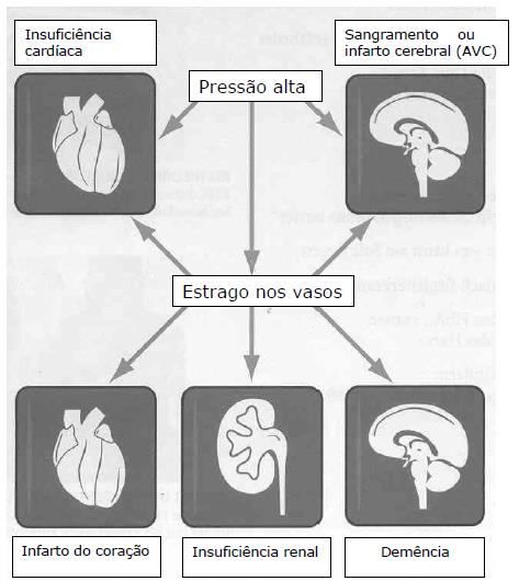 arteriole hipertónia)
